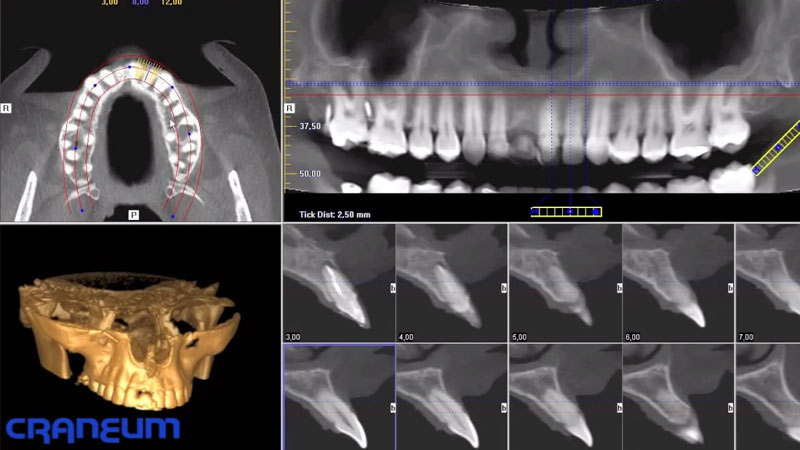 Página Cedimagem Diagnósticos - Tomografia do Maxilar e