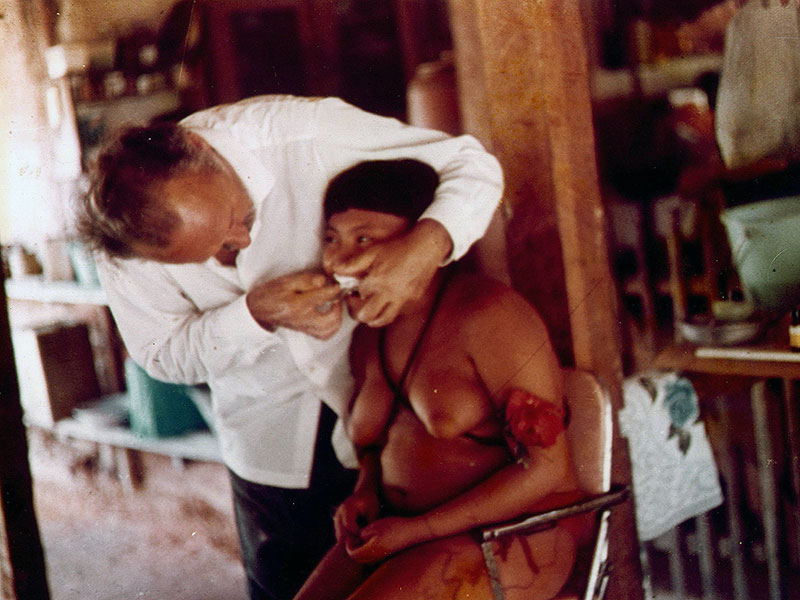 Dr. Astor Riesinger faz moldagem das arcadas dentárias de uma Yanomami (1971)