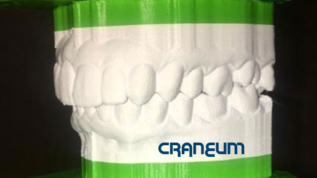 https://craneum.com.br/wp/wp-content/uploads/2019/06/mod3d.jpg